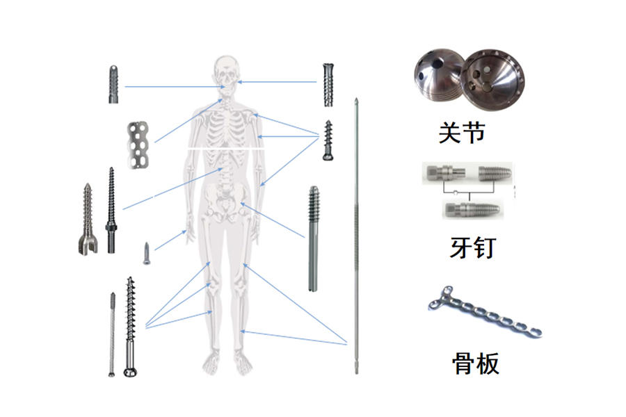 醫(yī)療骨科、牙釘、脊椎